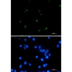 Invitrogen&trade;&nbsp;POLR2A Recombinant Rabbit Monoclonal Antibody (K01_2K64)
