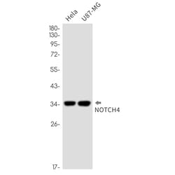 Invitrogen NOTCH4 Recombinant Rabbit Monoclonal Antibody (K01_2K71) 50 &mu;L | Buy Online | Invitrogen&trade; | Fisher Scientific
