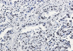 Invitrogen H3K27ac Recombinant Rabbit Monoclonal Antibody (K01_2K75) 100 &mu;L | Buy Online | Invitrogen&trade; | Fisher Scientific