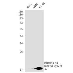 Invitrogen H3K27ac Recombinant Rabbit Monoclonal Antibody (K01_2K75) 100 &mu;L | Buy Online | Invitrogen&trade; | Fisher Scientific