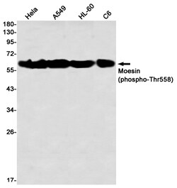 Invitrogen Phospho-Moesin (Thr558) Recombinant Rabbit Monoclonal Antibody (K01_2L03) 50 &mu;L | Buy Online | Invitrogen&trade; | Fisher Scientific
