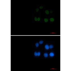 Invitrogen Phospho-RAD17 (Ser656) Recombinant Rabbit Monoclonal Antibody (K01_2L11) 100 &mu;L | Buy Online | Invitrogen&trade; | Fisher Scientific