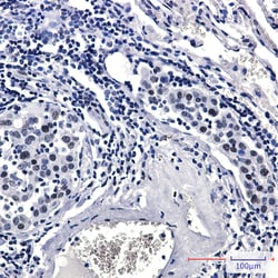Invitrogen Phospho-RAD17 (Ser656) Recombinant Rabbit Monoclonal Antibody (K01_2L11) 100 &mu;L | Buy Online | Invitrogen&trade; | Fisher Scientific