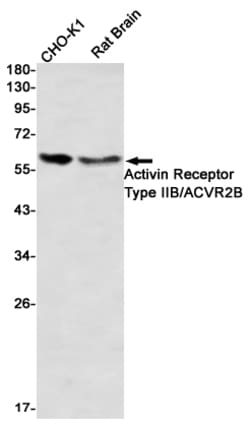 Invitrogen ACVR2B Recombinant Rabbit Monoclonal Antibody (K01_2L28) 50 &mu;L | Buy Online | Invitrogen&trade; | Fisher Scientific