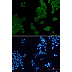 Invitrogen ACTR1B Recombinant Rabbit Monoclonal Antibody (K01_2L30) 100 &mu;L | Buy Online | Invitrogen&trade; | Fisher Scientific