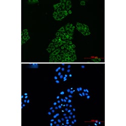 Invitrogen Adenylate Kinase 2 Recombinant Rabbit Monoclonal Antibody (K01_2L32) 100 &mu;L | Buy Online | Invitrogen&trade; | Fisher Scientific