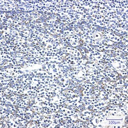 Invitrogen Adenylate Kinase 2 Recombinant Rabbit Monoclonal Antibody (K01_2L32) 100 &mu;L | Buy Online | Invitrogen&trade; | Fisher Scientific