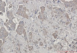 Invitrogen BID Recombinant Rabbit Monoclonal Antibody (K01_2L56) 100 &mu;L | Buy Online | Invitrogen&trade; | Fisher Scientific