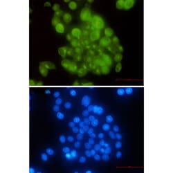 Invitrogen BUBR1 Recombinant Rabbit Monoclonal Antibody (K01_2L59) 100 &mu;L | Buy Online | Invitrogen&trade; | Fisher Scientific