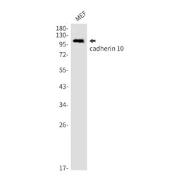Invitrogen CDH10 Recombinant Rabbit Monoclonal Antibody (K01_2L62) 50 &mu;L | Buy Online | Invitrogen&trade; | Fisher Scientific