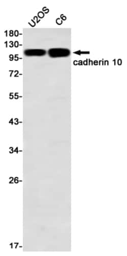 Invitrogen CDH10 Recombinant Rabbit Monoclonal Antibody (K01_2L62) 50 &mu;L | Buy Online | Invitrogen&trade; | Fisher Scientific