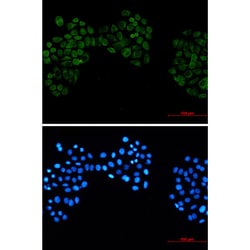 Invitrogen CK2 beta Recombinant Rabbit Monoclonal Antibody (K01_2L67) 100 &mu;L | Buy Online | Invitrogen&trade; | Fisher Scientific