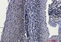Invitrogen CK2 beta Recombinant Rabbit Monoclonal Antibody (K01_2L67) 100 &mu;L | Buy Online | Invitrogen&trade; | Fisher Scientific