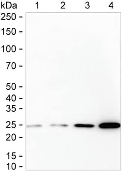 Invitrogen CK2 beta Recombinant Rabbit Monoclonal Antibody (K01_2L67) 100 &mu;L | Buy Online | Invitrogen&trade; | Fisher Scientific