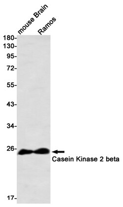 Invitrogen CK2 beta Recombinant Rabbit Monoclonal Antibody (K01_2L67) 100 &mu;L | Buy Online | Invitrogen&trade; | Fisher Scientific