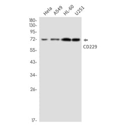 Invitrogen CD229 Recombinant Rabbit Monoclonal Antibody (K01_2L74) 100 &mu;L | Buy Online | Invitrogen&trade; | Fisher Scientific