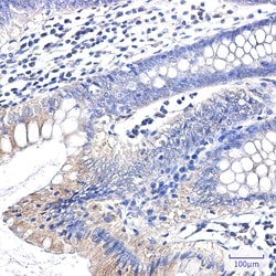 Invitrogen Clathrin Heavy Chain Recombinant Rabbit Monoclonal Antibody (K01_2L86) 100 &mu;L | Buy Online | Invitrogen&trade; | Fisher Scientific