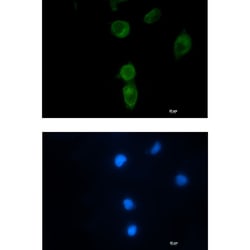 Invitrogen CLPX Recombinant Rabbit Monoclonal Antibody (K01_2L89) 50 &mu;L | Buy Online | Invitrogen&trade; | Fisher Scientific