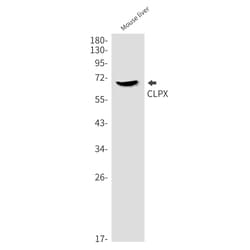 Invitrogen CLPX Recombinant Rabbit Monoclonal Antibody (K01_2L89) 50 &mu;L | Buy Online | Invitrogen&trade; | Fisher Scientific