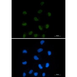 Invitrogen CtBP1 Recombinant Rabbit Monoclonal Antibody (K01_2L97) 100 &mu;L | Buy Online | Invitrogen&trade; | Fisher Scientific
