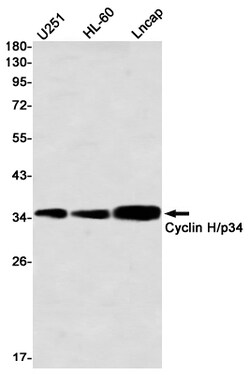 Invitrogen Cyclin H Recombinant Rabbit Monoclonal Antibody (K01_2M03) 100 &mu;L | Buy Online | Invitrogen&trade; | Fisher Scientific