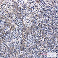 Invitrogen Cystatin B Recombinant Rabbit Monoclonal Antibody (K01_2M05) 100 &mu;L | Buy Online | Invitrogen&trade; | Fisher Scientific