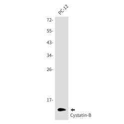 Invitrogen Cystatin B Recombinant Rabbit Monoclonal Antibody (K01_2M05) 100 &mu;L | Buy Online | Invitrogen&trade; | Fisher Scientific