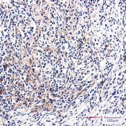 Invitrogen DAB2 Recombinant Rabbit Monoclonal Antibody (K01_2M07) 50 &mu;L | Buy Online | Invitrogen&trade; | Fisher Scientific