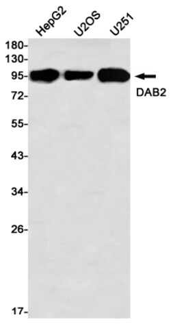 Invitrogen DAB2 Recombinant Rabbit Monoclonal Antibody (K01_2M07) 50 &mu;L | Buy Online | Invitrogen&trade; | Fisher Scientific