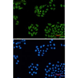 Invitrogen™ DDB1 Recombinant Rabbit Monoclonal Antibody (K01_2M09)