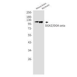 Invitrogen DGKZ Recombinant Rabbit Monoclonal Antibody (K01_2M13) 50 &mu;L | Buy Online | Invitrogen&trade; | Fisher Scientific