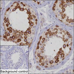 Invitrogen KIF11 Recombinant Rabbit Monoclonal Antibody (K01_2M24) 100 &mu;L | Buy Online | Invitrogen&trade; | Fisher Scientific