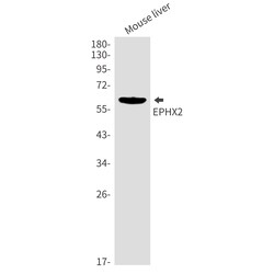 Invitrogen EPHX2 Recombinant Rabbit Monoclonal Antibody (K01_2M28) 100 &mu;L | Buy Online | Invitrogen&trade; | Fisher Scientific