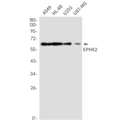 Invitrogen EPHX2 Recombinant Rabbit Monoclonal Antibody (K01_2M28) 100 &mu;L | Buy Online | Invitrogen&trade; | Fisher Scientific