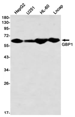Invitrogen&trade;&nbsp;GBP1 Recombinant Rabbit Monoclonal Antibody (K01_2M50)