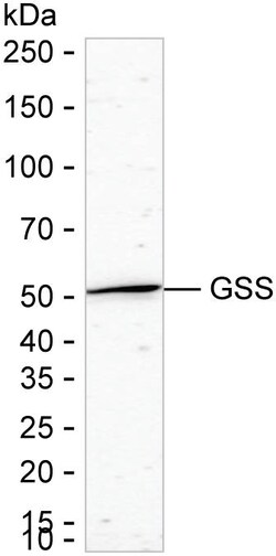 Invitrogen GSS Recombinant Rabbit Monoclonal Antibody (K01_2M54) 50 &mu;L | Buy Online | Invitrogen&trade; | Fisher Scientific