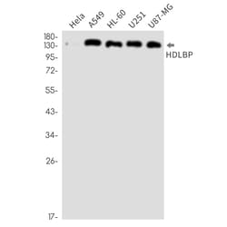 Invitrogen HDLBP Recombinant Rabbit Monoclonal Antibody (K01_2M63) 100 &mu;L | Buy Online | Invitrogen&trade; | Fisher Scientific