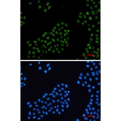 Invitrogen Histone H2A.X Recombinant Rabbit Monoclonal Antibody (K01_2M71) 100 &mu;L | Buy Online | Invitrogen&trade; | Fisher Scientific