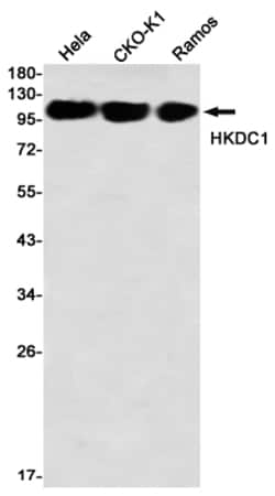 Invitrogen HKDC1 Recombinant Rabbit Monoclonal Antibody (K01_2M73) 50 &mu;L | Buy Online | Invitrogen&trade; | Fisher Scientific