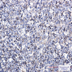 Invitrogen ICAM3 Recombinant Rabbit Monoclonal Antibody (K01_2M82) 100 &mu;L | Buy Online | Invitrogen&trade; | Fisher Scientific