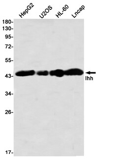 Invitrogen IHH Recombinant Rabbit Monoclonal Antibody (K01_2M85) 50 &mu;L | Buy Online | Invitrogen&trade; | Fisher Scientific