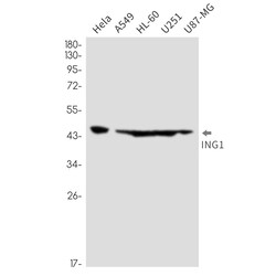 Invitrogen ING1 Recombinant Rabbit Monoclonal Antibody (K01_2M91) 100 &mu;L | Buy Online | Invitrogen&trade; | Fisher Scientific