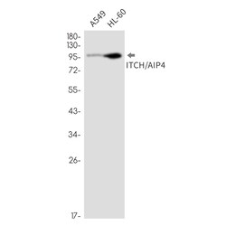 Invitrogen ITCH Recombinant Rabbit Monoclonal Antibody (K01_2M95) 100 &mu;L | Buy Online | Invitrogen&trade; | Fisher Scientific
