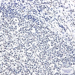 Invitrogen Ku70 Recombinant Rabbit Monoclonal Antibody (K01_2N03) 100 &mu;L | Buy Online | Invitrogen&trade; | Fisher Scientific