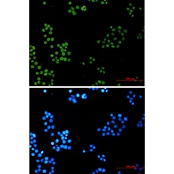 Invitrogen DNA Ligase I Recombinant Rabbit Monoclonal Antibody (K01_2N08) 100 &mu;L | Buy Online | Invitrogen&trade; | Fisher Scientific