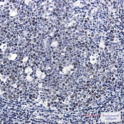 Invitrogen DNA Ligase I Recombinant Rabbit Monoclonal Antibody (K01_2N08) 100 &mu;L | Buy Online | Invitrogen&trade; | Fisher Scientific