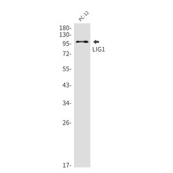 Invitrogen DNA Ligase I Recombinant Rabbit Monoclonal Antibody (K01_2N08) 100 &mu;L | Buy Online | Invitrogen&trade; | Fisher Scientific