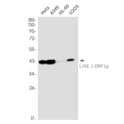 Invitrogen L1RE1 Recombinant Rabbit Monoclonal Antibody (K01_2N10) 50 &mu;L | Buy Online | Invitrogen&trade; | Fisher Scientific