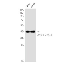 Invitrogen L1RE1 Recombinant Rabbit Monoclonal Antibody (K01_2N11) 100 &mu;L | Buy Online | Invitrogen&trade; | Fisher Scientific