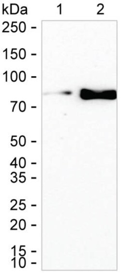 Invitrogen LTK Recombinant Rabbit Monoclonal Antibody (K01_2N14) 100 &mu;L | Buy Online | Invitrogen&trade; | Fisher Scientific